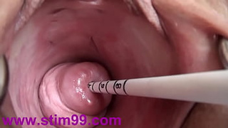 Extreme Real Cervix Fucking Insertion Chinese Sounds and Objects in Uterus