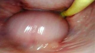 AMAZING INTERNAL SELF PERSPECTIVE. WEBCAM INSIDE HER VAGINA WHILE I FILL HER WITH JIZZ