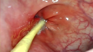 EXTREME ANAL POINT OF VIEW. WEBCAM INSIDE HER BUTT-HOLE AS I POUND HER WITH MY MASSIVE PRICK AND JIZZ DEEP INSIDE