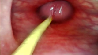 EXTREME ANAL POINT OF VIEW. WEB-CAM INSIDE HER ASS-HOLE AS I POUND HER WITH MY ENORMOUS DONG AND SPERM DEEP INSIDE