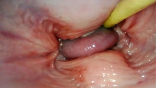 AMAZING INTERNAL SELF PERSPECTIVE. CAM INSIDE HER VAGINA WHILE I FILL HER WITH JIZZ